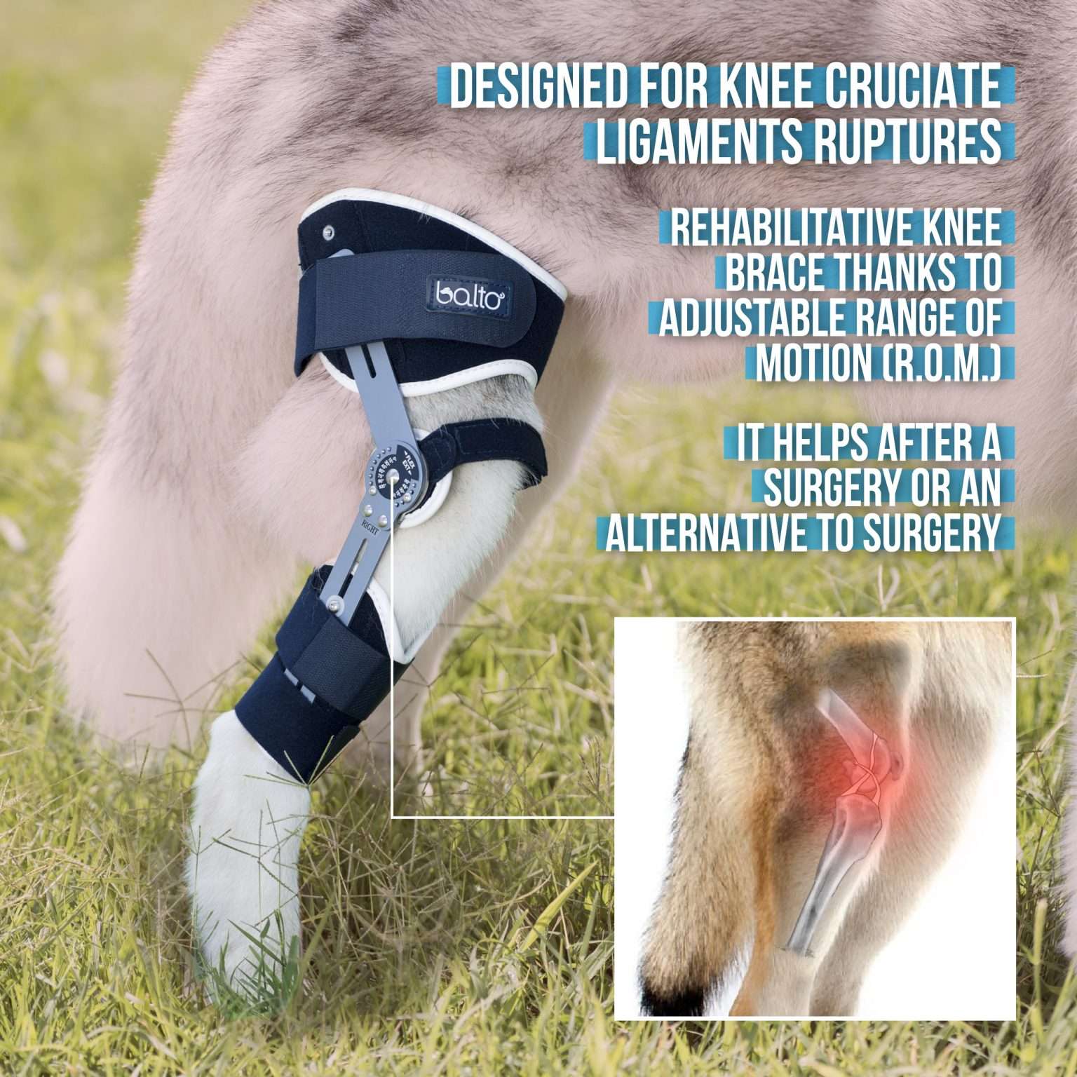 BALTO Ligatek Ортопедска протеза за колено и клучни лигаменти - Image 3